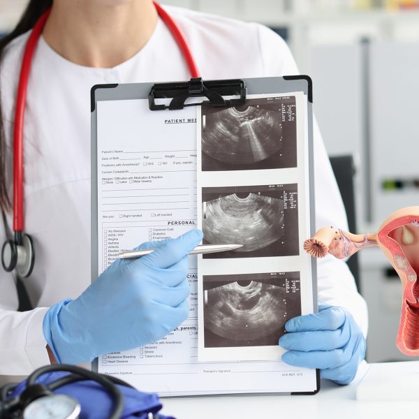 Gynecologist shows ultrasound of uterus in office. Instructional model of female reproductive system concept