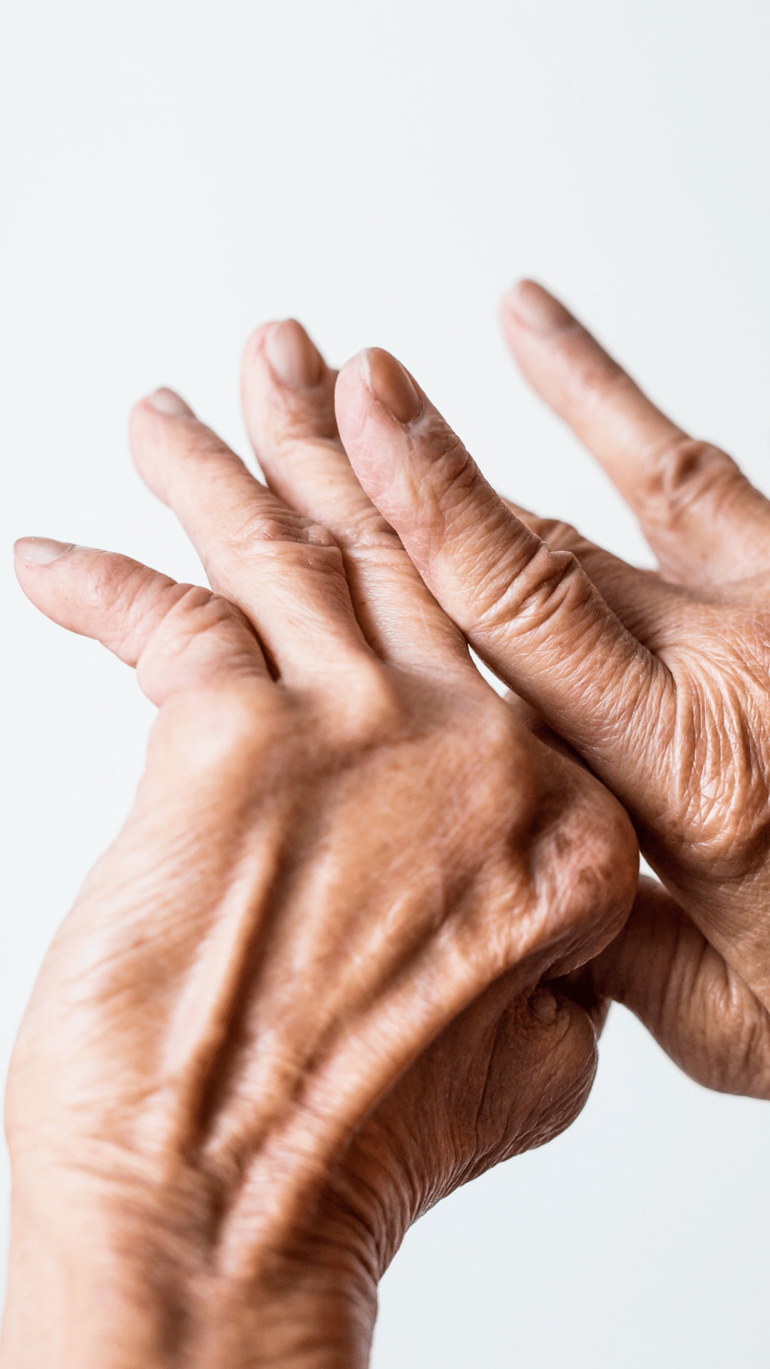 Ревматоїдний артрит