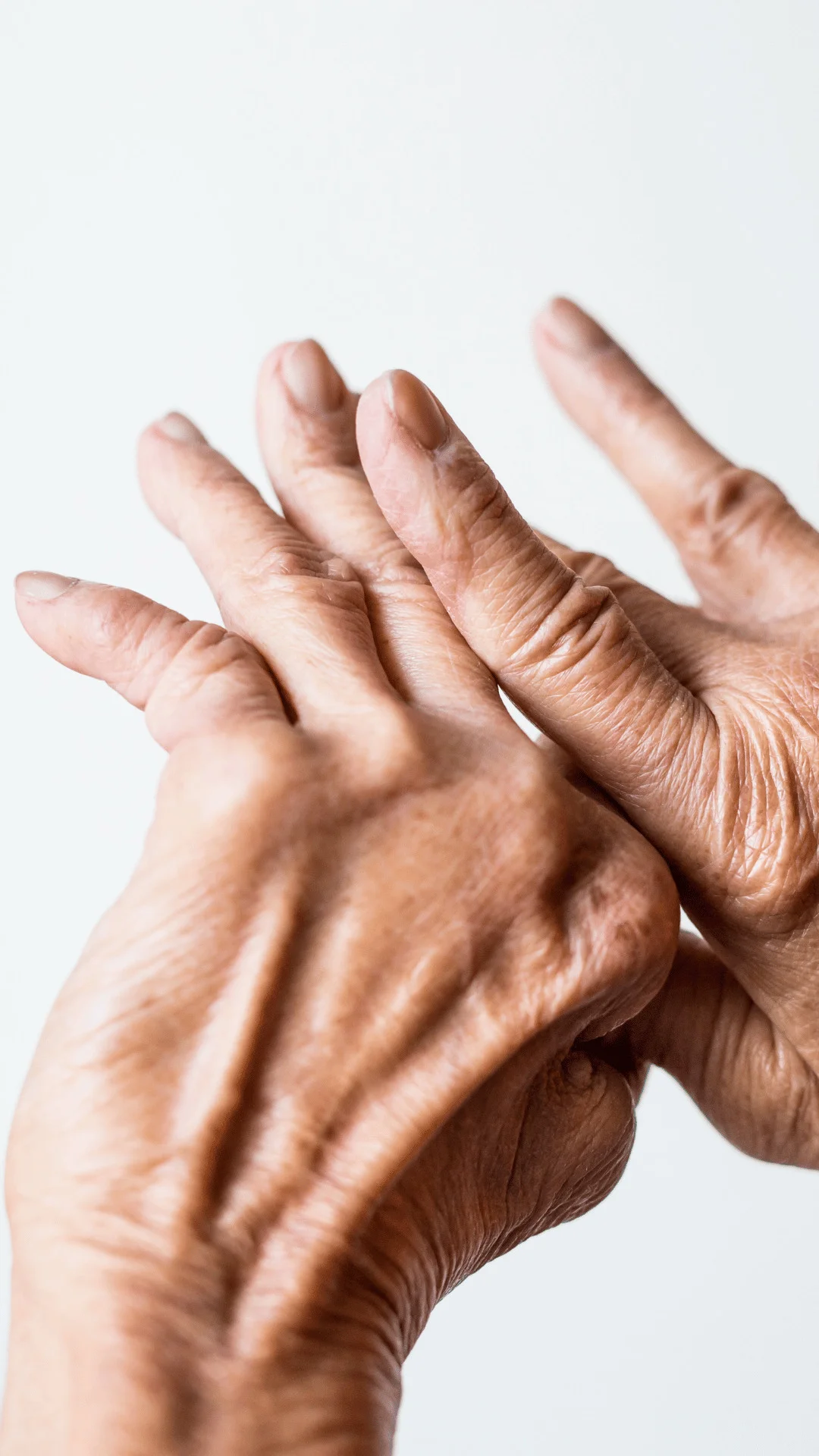 Ревматоїдний артрит