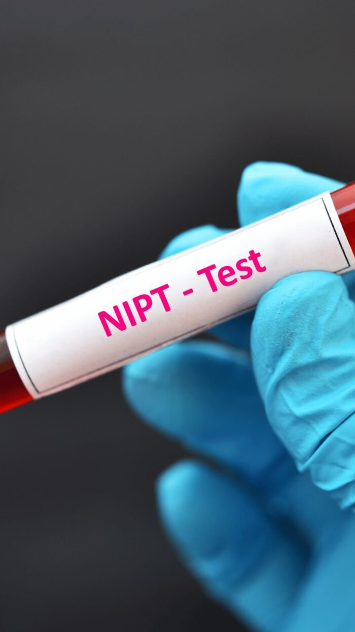 NIPT – Неінвазивний пренатальний тест Рекомендовано всім вагітним